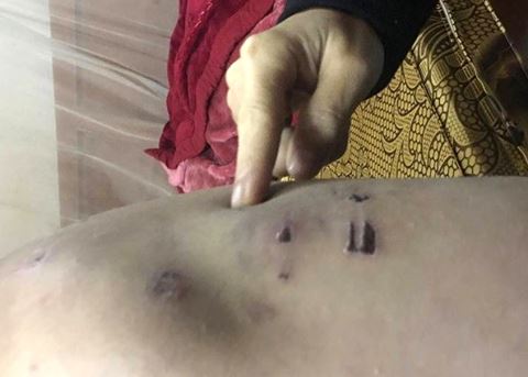 Chủ tịch Hà Nội yêu cầu điều tra, xử lý vụ việc bé trai 9 tuổi bị cha đẻ bạo hành ảnh 1